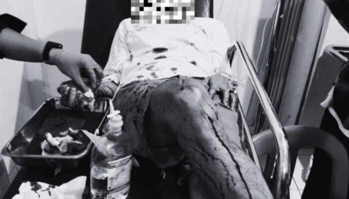 Malam Tahun Baru Berubah Mencekam, Empat Remaja Jadi Korban Pembacokan